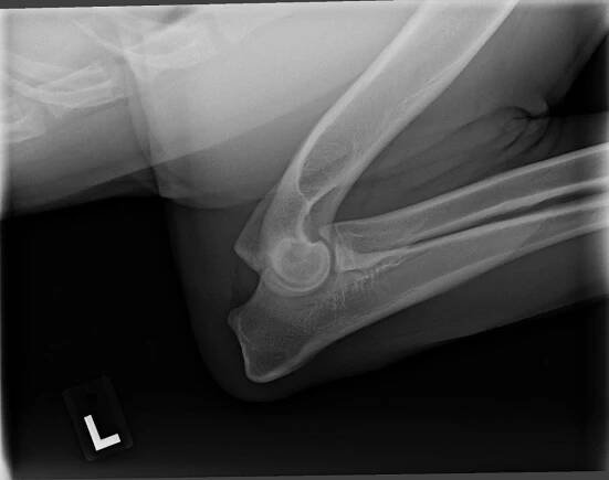 Corvo's Left Elbow