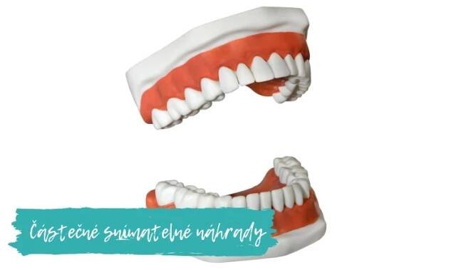 Částečné snímatelné náhrady - Stomatologie dSmile Praha
