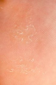 Suchá kůže textura — Stock obrázek