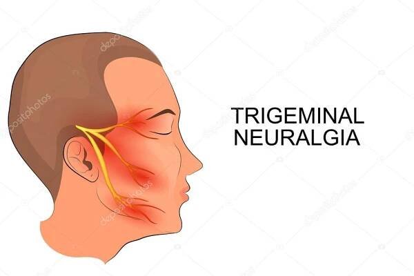 Stáhnout - Ilustrace mužské hlavy. neuralgie trigeminu. neuroscienc — Ilustrace
