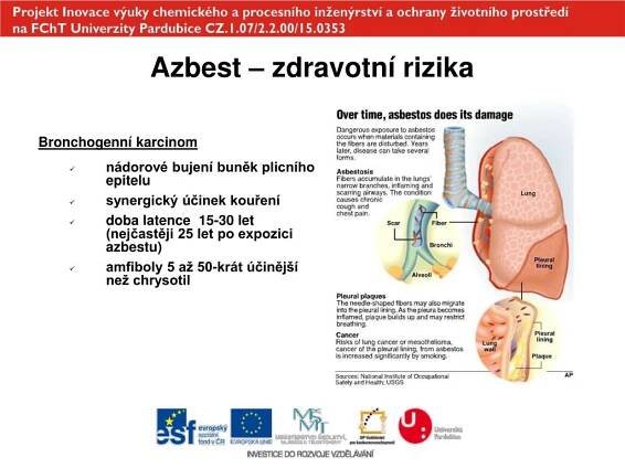 PPT - Zdravotní rizika spojená s expozicí azbestu PowerPoint Presentation - ID:743027