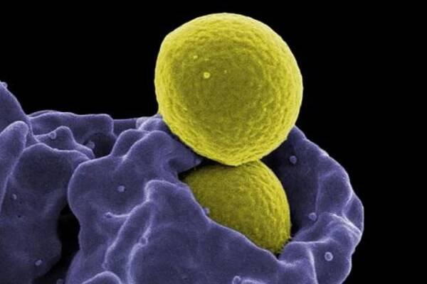 Methicillin-resistant Staphylococcus aureus (MRSA)