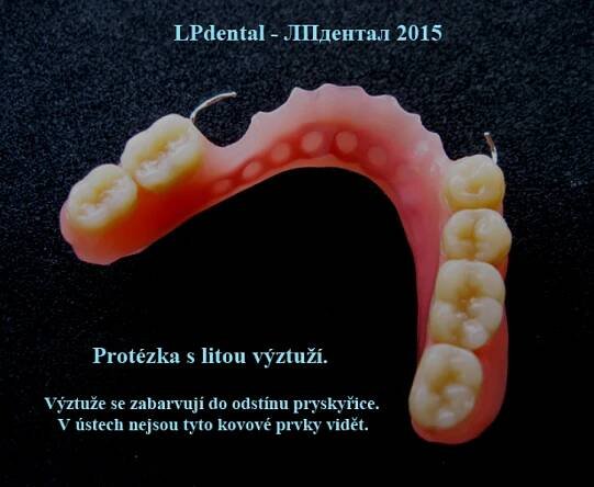 Částečné snímatelné náhrady | LPdental.cz