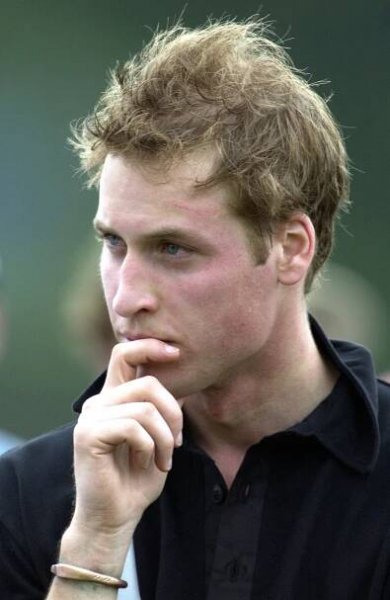 Prince William Has a Legit Harry Potter Scar on His Forehead ​and the Story Behind It Is Wild | Prince william, Prince, Prince william young