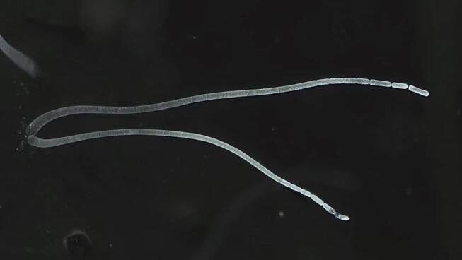 Thiomargarita magnifica