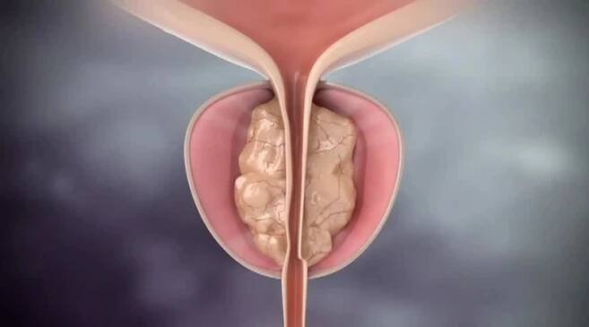 ANDROGEOS | Urologie Praha | Andrologie | Uroonkologie | Hlavní město Praha | Česko