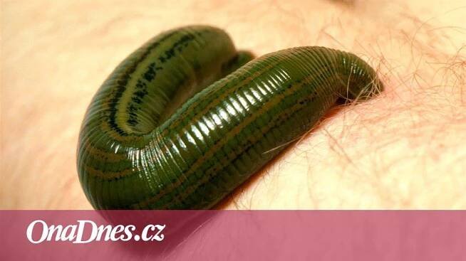 Vysávají vaši krev a přitom pomáhají. Pijavice léčí už staletí - iDNES.cz