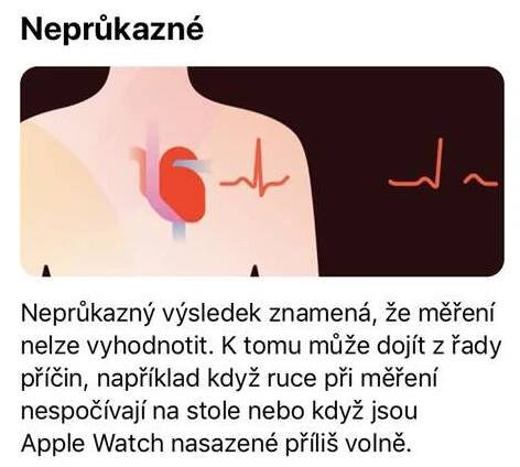 Apple konečně pustil EKG i na české Apple Watch. Co umí a jak vše nastavit? – MobilMania.cz