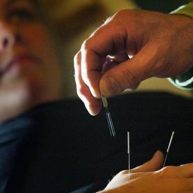 Should acupuncture be used more widely in the NHS?