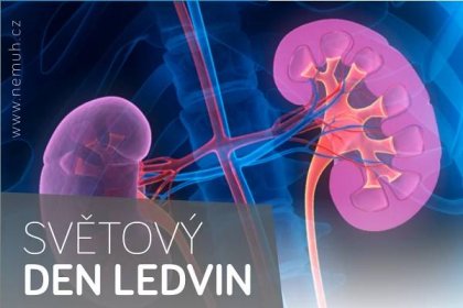 Blíží se Světový den ledvin. Uherskohradišťská nemocnice připravuje preventivní akci - ZLIN.CZ