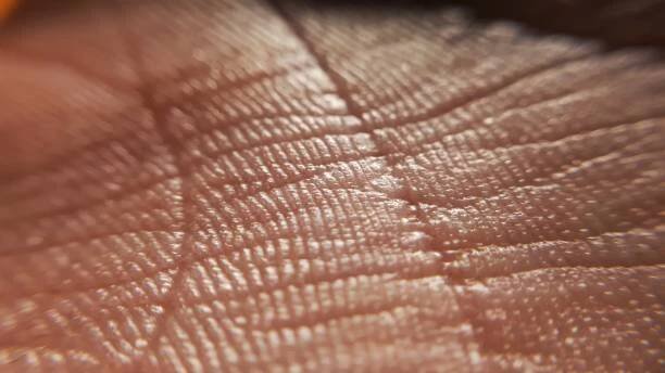 kontaktní dermatitida. koncept kožních onemocnění. makro kůže lidské ruky. koncept medicíny a dermatologie. podrobnosti o pozadí lidské kůže - kontaktní dermatitida - stock snímky, obrázky a fotky