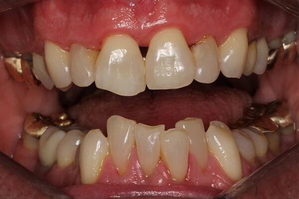 Before and After • 425 Dental