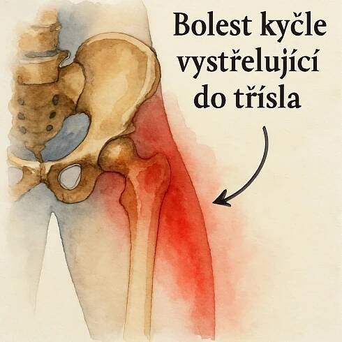 Bolest kyčle vystřelující do třísla: Co signalizuje a jak ji řešit odborně a přirozeně