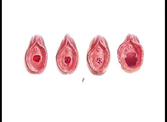 Genitales Femeninos Externos