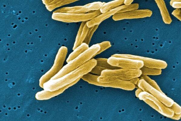 Bacteria