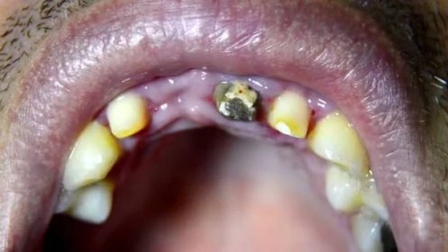 Zubní kontrola zubů připravená na lávku — Stock záběr