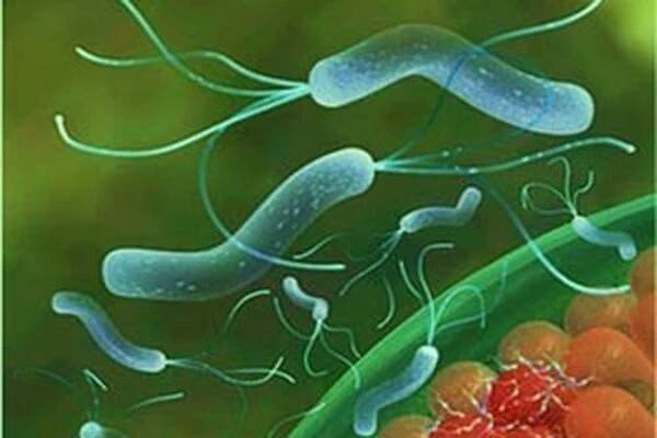 Test Helicobacter pylori / Helicobacter | Užitečné informace a tipy na péči o sebe. Zdraví, výživa a další.