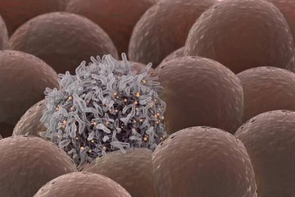 Vědci z Colorada objevili terapii, která dokáže zastavit růst nádoru, zvláště důležitý pro pacienty s melanomem