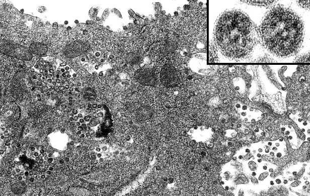 cytoplazmatické, membrána, vázané, vakuoly, cisternae, drsné, endoplazmatické, retikulum