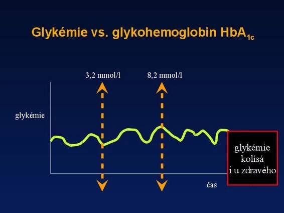 Glykovaný hemoglobin – absolutní parametr pro lékaře i pacienta | cukrovka