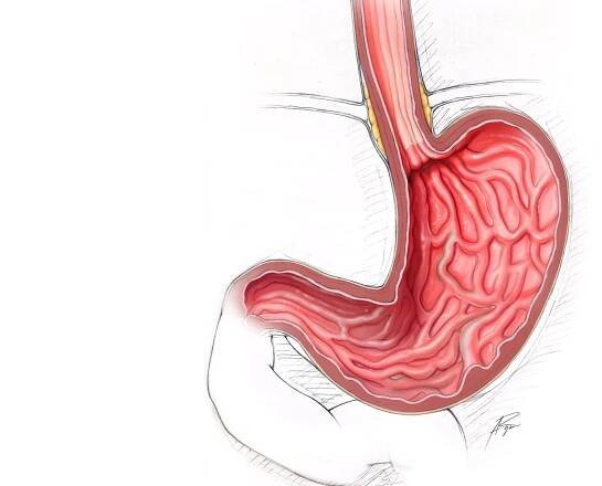 LSI SOLUTIONS® Stomach Illustration by Anthony Ryan
