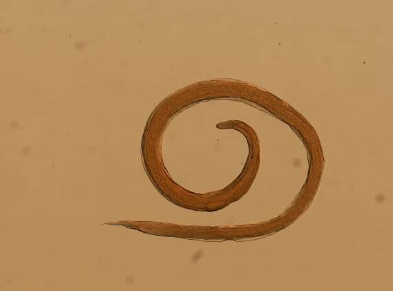 Rhabdias ranae