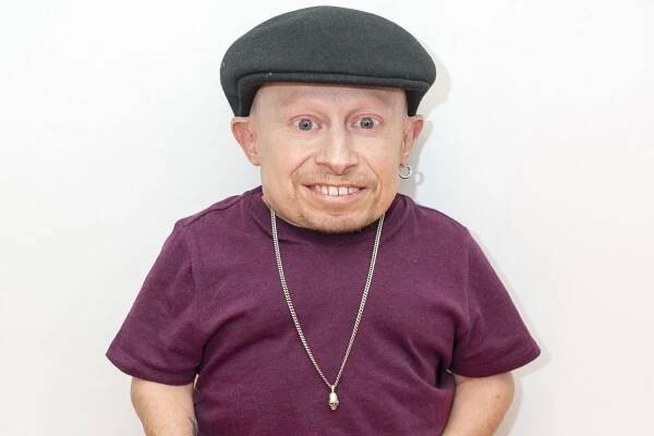 Austin Powers Star Verne Troyer Dies at 49