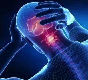Cervikogenní bolest hlavy (přenesená bolest hlavy z oblasti krční páteře) - jak ji řešit?