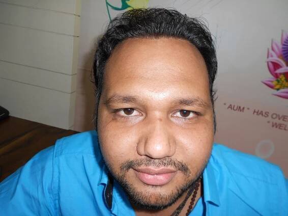 Spiral Skin And Hair Transplant Centre – Spiral Skin Clinic