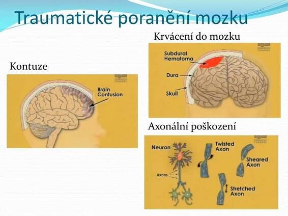 PPT - Struktura přednášky PowerPoint Presentation, free download - ID ...