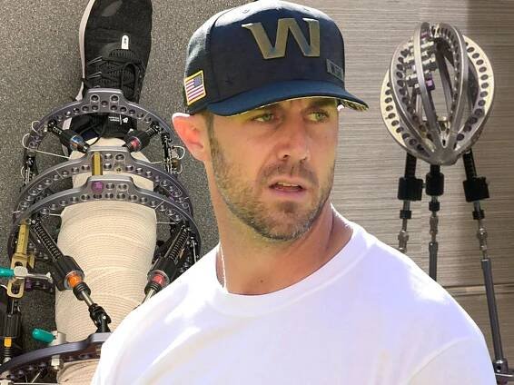 NFL's Alex Smith Transforms Leg-Saving Contraption Into 'Trophy Of Triumph'