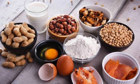 složení s běžnými potravinovým alergeny - food allergies - stock snímky, obrázky a fotky