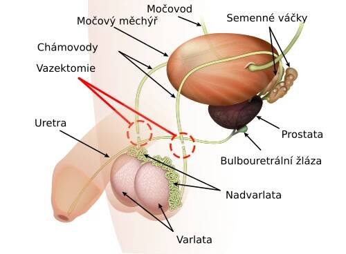 Vasektomie – Wikipedie