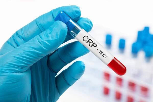 Jako CRP se označuje C-reaktivní protein, jenž patří mezi proteiny akutní fáze, které se podílejí na imunitní reakci organismu.