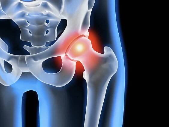 Prevent Hip Pain - Effective Tips and Techniques