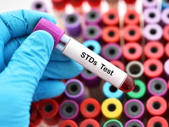 krev pro std test - herpes zoster - stock snímky, obrázky a fotky