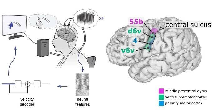 Brain region used for speech decoding also supports BCI cursor control – Physics World