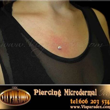 Microdermal - Via Paradox