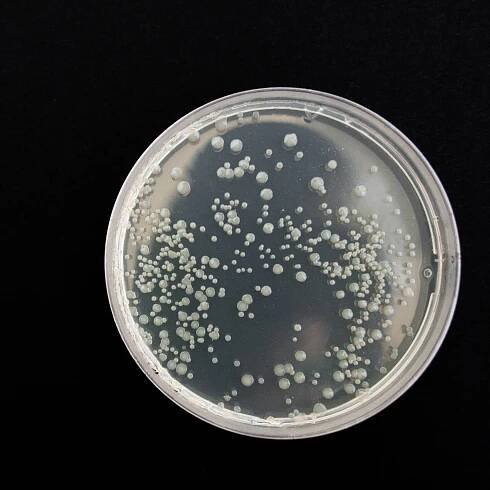 Průlom v boji s rezistentními bakteriemi: Vědci na MIT využívají umělou inteligenci k vývoji nového antibiotika Aubacin