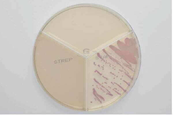 Staphylococcus aureus