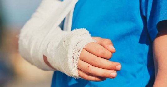 Jak si zlomit ruku bez bolesti: Návod k provedení
