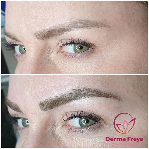 DermaFreya foto 2