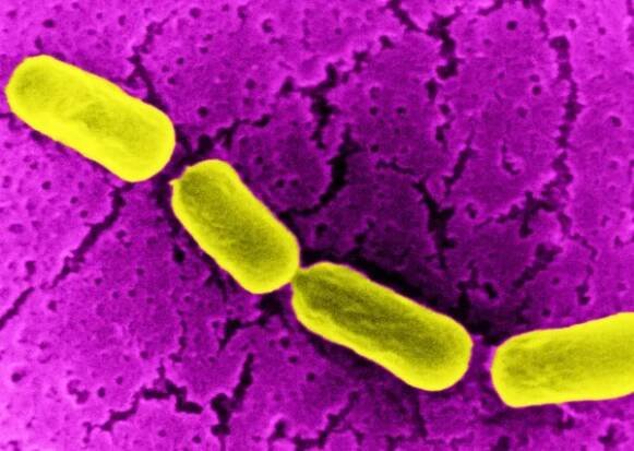 Anaerobní bakterii bacillus — Stock obrázek