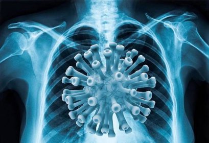 koronavirová nemoc covid-19 virová infekce v lidských plicích - dutina hrudní - stock snímky, obrázky a fotky
