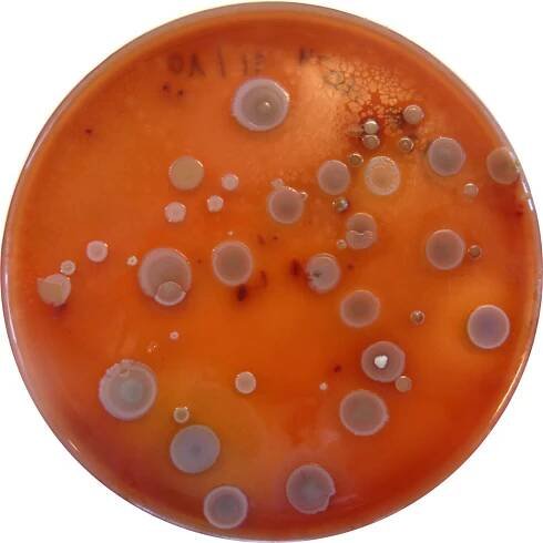 Underarm bacteria - Doctor Armpit