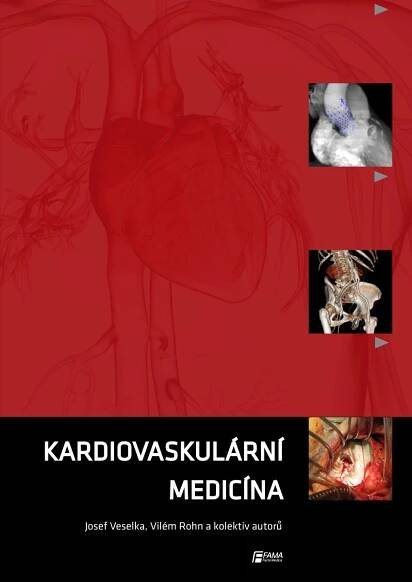 Kardiovaskulární medicína - Nakladatelství a vydavatelství - Facta Medica, s.r.o.