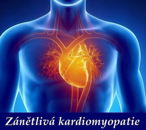 Zánětlivá kardiomyopatie – příznaky, projevy, symptomy, příčina, léčba