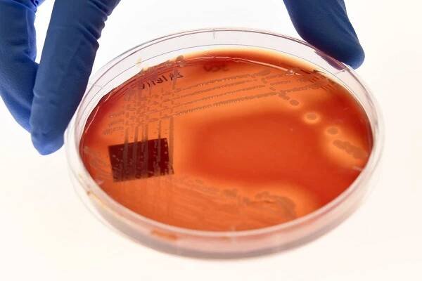 UK aid cuts could lead to millions more dying from superbug infections, study warns