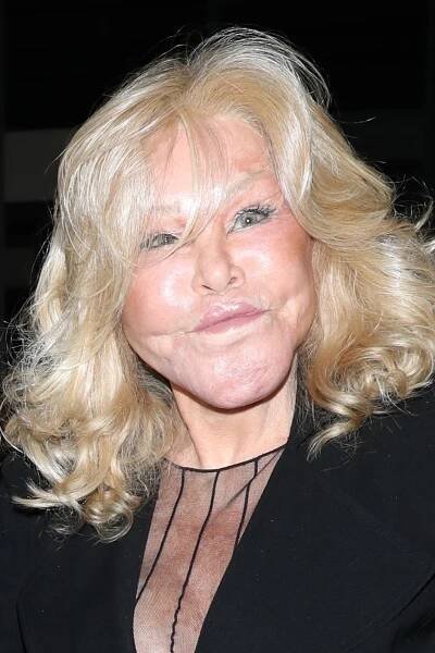 FOTO: Jocelyn Wildenstein prošla mnoha plastikami. – stránka 14