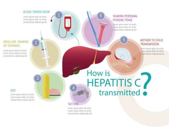 játra obklopená 6 možnými možnostmi přenosu onemocnění - hepatitida b stock ilustrace